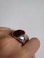 Any Ring
